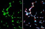 TCF3 Antibody in Immunocytochemistry (ICC/IF)