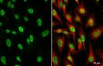 TCF3 Antibody in Immunocytochemistry (ICC/IF)