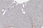 IGF1R (CD221) Antibody in Immunohistochemistry (Paraffin) (IHC (P))