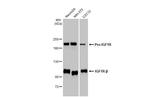 IGF1R (CD221) Antibody in Western Blot (WB)