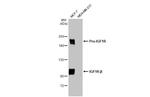 IGF1R (CD221) Antibody in Western Blot (WB)