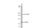 IGF1R (CD221) Antibody in Western Blot (WB)