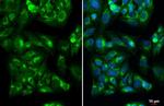 IGF2 Antibody in Immunocytochemistry (ICC/IF)