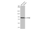 PFKM Antibody in Western Blot (WB)