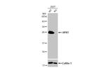 HPRT1 Antibody in Western Blot (WB)