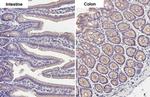 Desmoglein 2 Antibody in Immunohistochemistry (Paraffin) (IHC (P))