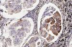 MX1 Antibody in Immunohistochemistry (Paraffin) (IHC (P))