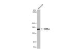 KDM6A Antibody in Western Blot (WB)