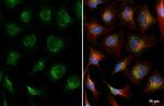 Plasminogen Antibody in Immunocytochemistry (ICC/IF)