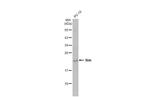 SHH Antibody in Western Blot (WB)