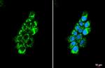 OAT Antibody in Immunocytochemistry (ICC/IF)