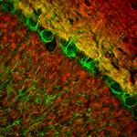 NEFL Antibody in Immunohistochemistry (PFA fixed) (IHC (PFA))