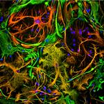 Vimentin Antibody in Immunocytochemistry (ICC/IF)