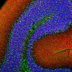 alpha Synuclein Antibody in Immunohistochemistry (PFA fixed) (IHC (PFA))