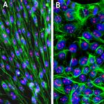 Fibrillarin Antibody in Immunocytochemistry (ICC/IF)