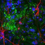 Aldolase C Antibody in Immunocytochemistry (ICC/IF)