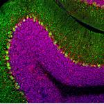 MECP2 Antibody in Immunohistochemistry (PFA fixed) (IHC (PFA))