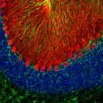 Calbindin D28K Antibody in Immunohistochemistry (PFA fixed) (IHC (PFA))