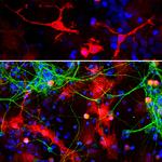 Galectin 3 Antibody in Immunocytochemistry (ICC/IF)