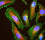 Actin Antibody in Immunocytochemistry (ICC/IF)