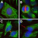 Aurora B Antibody in Immunocytochemistry (ICC/IF)