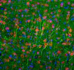 NEFL Antibody in Immunohistochemistry (PFA fixed) (IHC (PFA))