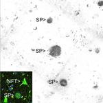 beta Amyloid Antibody in Immunohistochemistry (IHC)