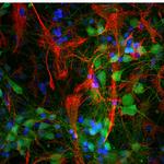 PGP9.5 Antibody in Immunocytochemistry (ICC/IF)