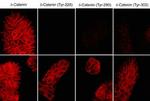 Phospho-delta Catenin (Tyr228) Antibody in Immunocytochemistry (ICC/IF)