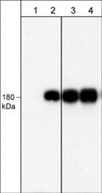 Phospho-EGFR (Tyr1101) Antibody in Western Blot (WB)