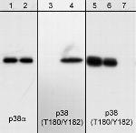 Phospho-p38 MAPK (Thr180, Tyr182) Antibody in Western Blot (WB)