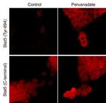 Phospho-STAT5 (Tyr694) Antibody in Immunocytochemistry (ICC/IF)