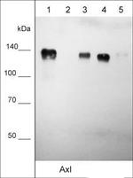 AXL Antibody in Western Blot (WB)