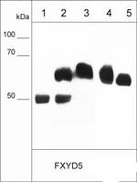 Dysadherin Antibody in Immunocytochemistry (ICC/IF)