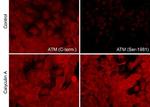 ATM Antibody in Immunocytochemistry (ICC/IF)