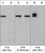 ATM Antibody in Western Blot (WB)