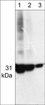 CDK5 Antibody in Western Blot (WB)