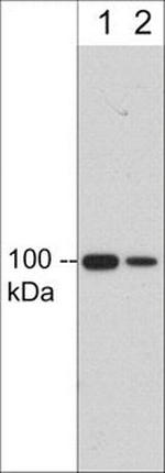 CD61 (Integrin beta 3) Antibody in Western Blot (WB)