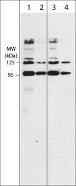 SEMA3A Antibody in Western Blot (WB)