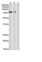 6x His Tag Chimeric Antibody in Western Blot (WB)