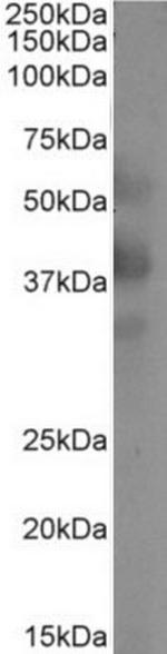 CD299 (DC-SIGN/L) Chimeric Antibody in Western Blot (WB)