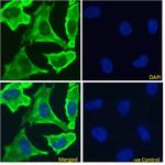 EGFR Chimeric Antibody in Immunocytochemistry (ICC/IF)