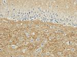 SNAP25 Antibody in Immunohistochemistry (PFA fixed) (IHC (PFA))