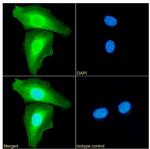 Annexin A1 Antibody in Immunocytochemistry (ICC/IF)