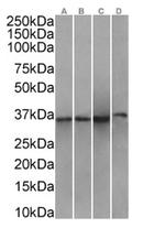 Annexin A1 Antibody in Western Blot (WB)