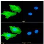 Calreticulin Antibody in Immunocytochemistry (ICC/IF)