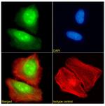 FEN1 Antibody in Immunocytochemistry (ICC/IF)