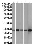 PRDX2 Antibody in Western Blot (WB)