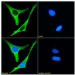 Ezrin Antibody in Immunocytochemistry (ICC/IF)