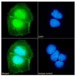 UBE2C Antibody in Immunocytochemistry (ICC/IF)